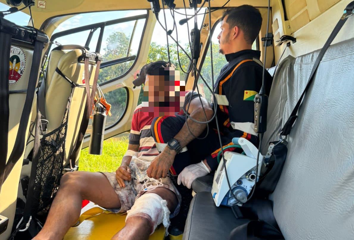Homem quase tem perna dilacerada por motosserra e é resgatado de helicóptero