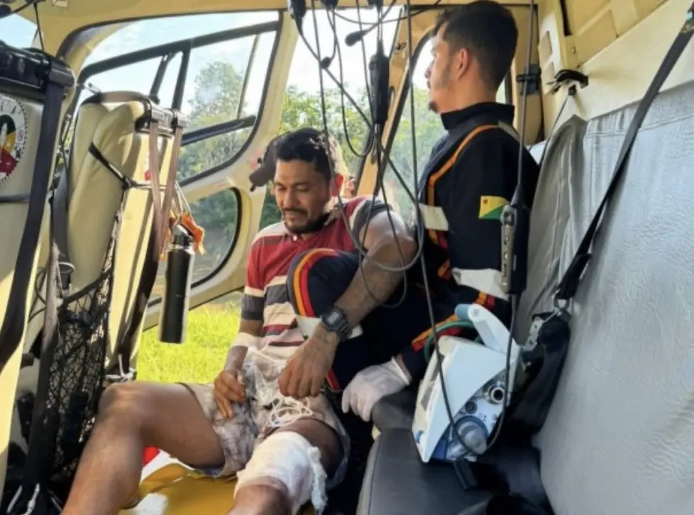 Homem sofre acidente com motosserra em área de difícil acesso em Cruzeiro do Sul