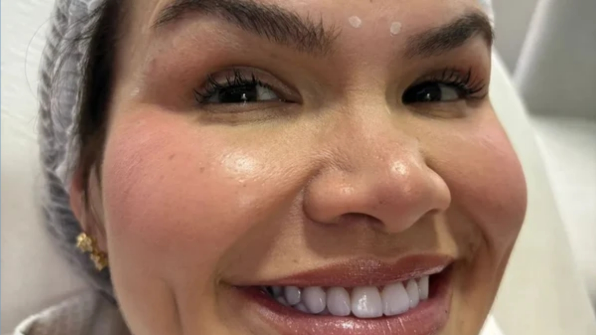 Saiba qual procedimento Thais Carla fez no rosto após perder 80 kg