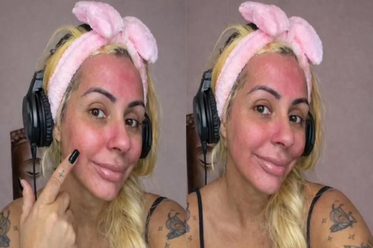 Influencer sofre alergia após passar sangue menstrual no rosto