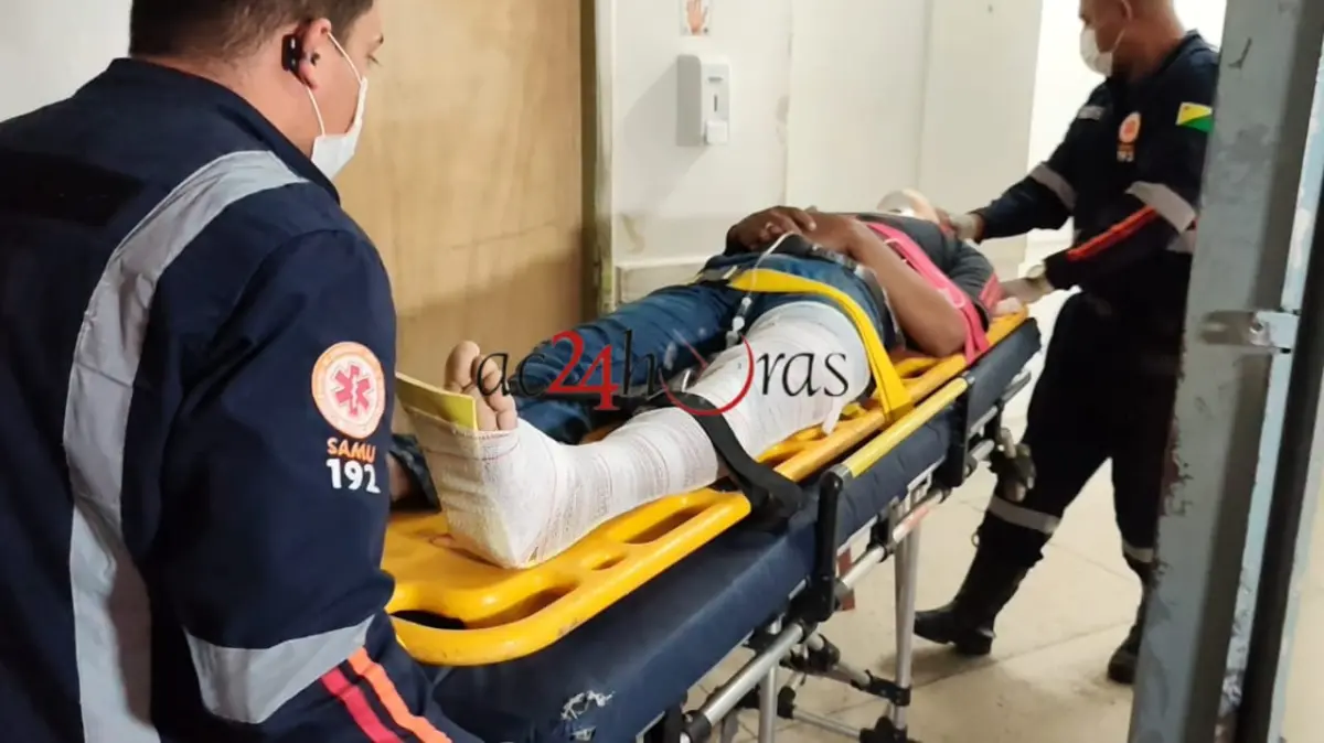 Homem empina moto, colide contra muro e sofre múltiplas fraturas em Rio Branco