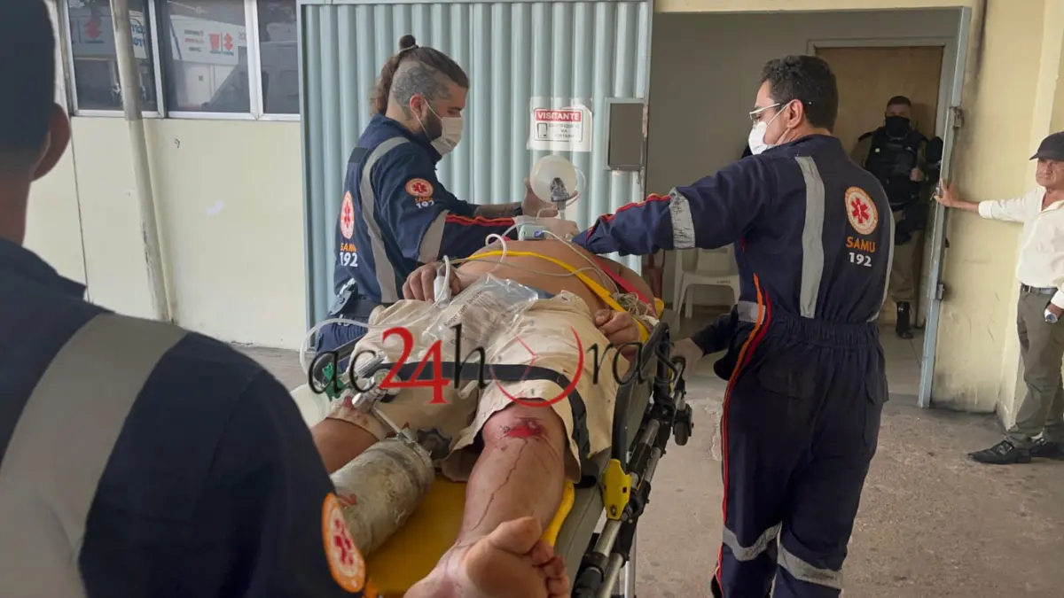 Acidente de moto no bairro Alto Alegre deixa homem em estado grave