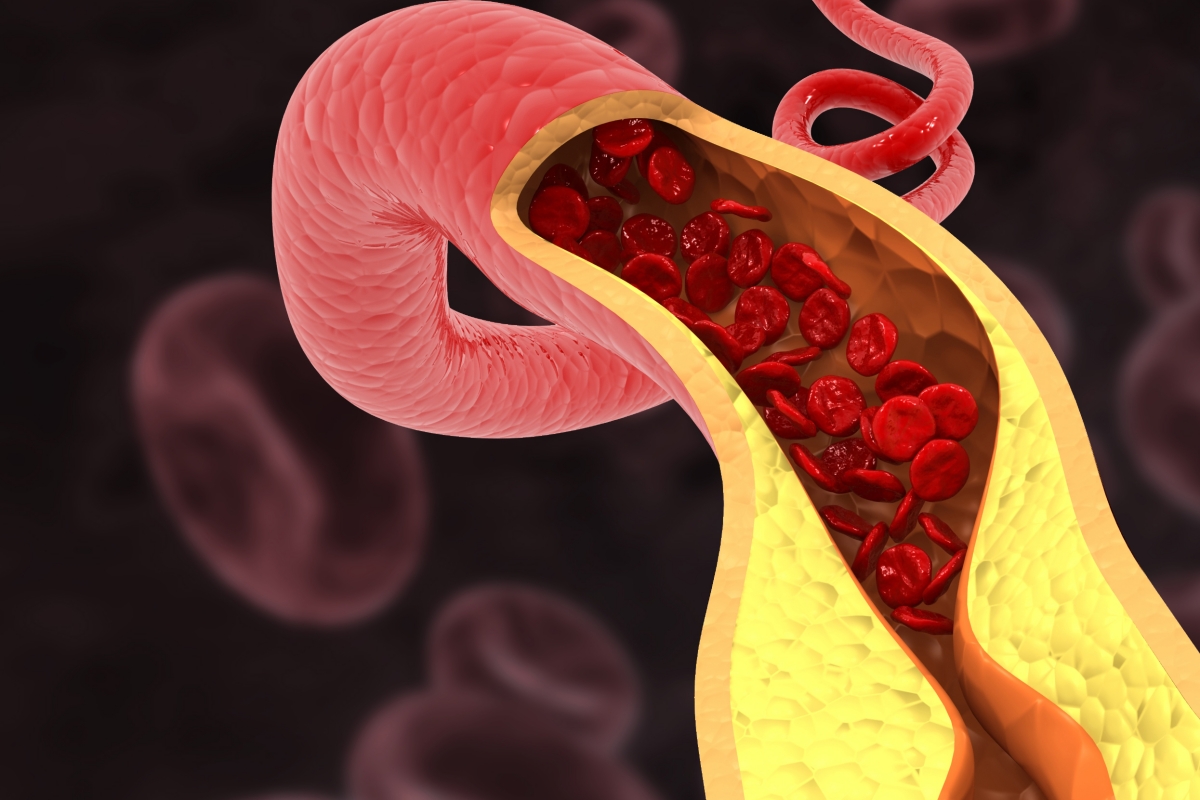 Colesterol alto? O que comer para ajudar a controlar o quadro