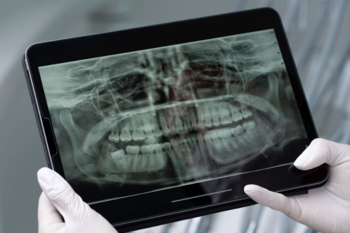 USP: saliva artificial ajuda a proteger dentes de pacientes com câncer