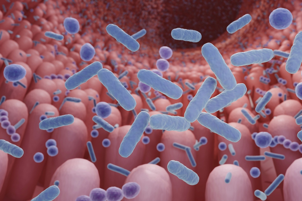 Coloproctologista lista os 5 melhores probióticos para o intestino