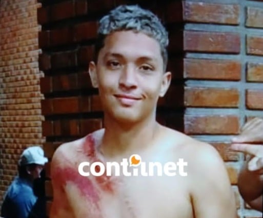 Sobrevivente de capotamento na BR-364 recebe alta do Pronto-Socorro de Rio Branco