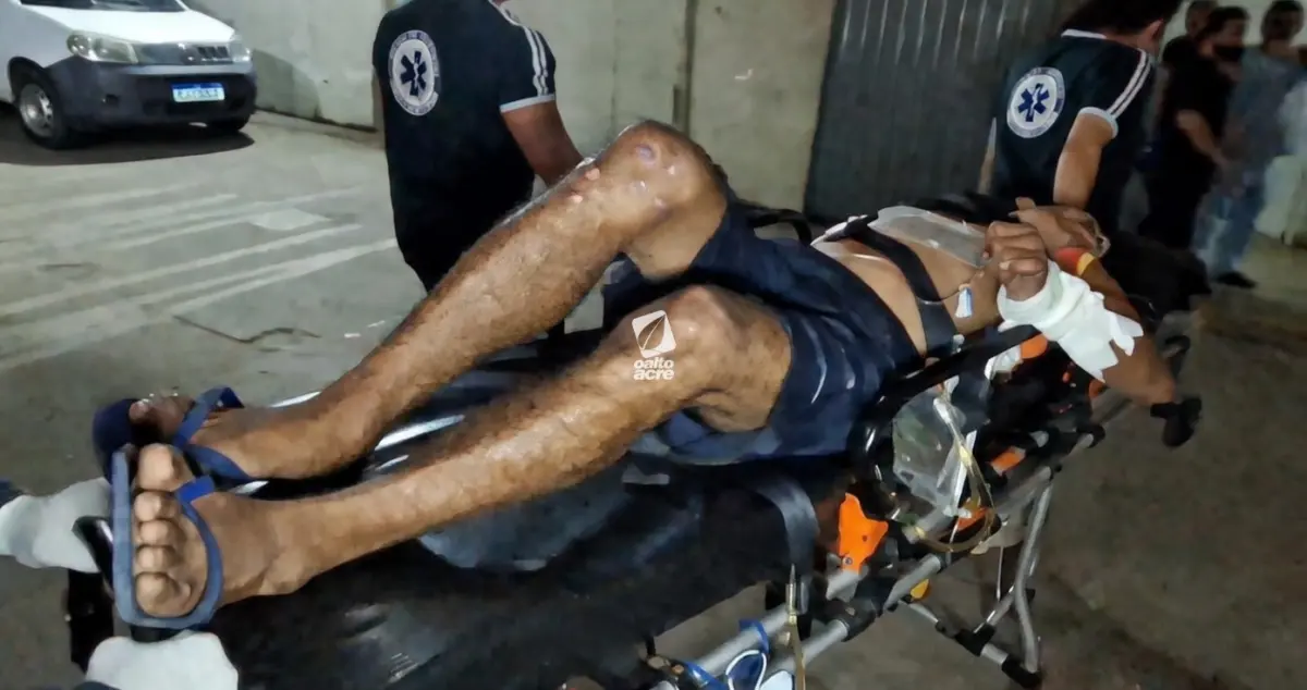 Ataque de dupla em motocicleta deixa dois baleados no interior do Acre