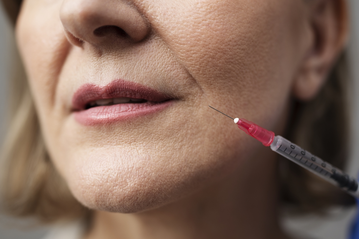 Anvisa proíbe venda de bioestimulador de colágeno Sculptra falsificado