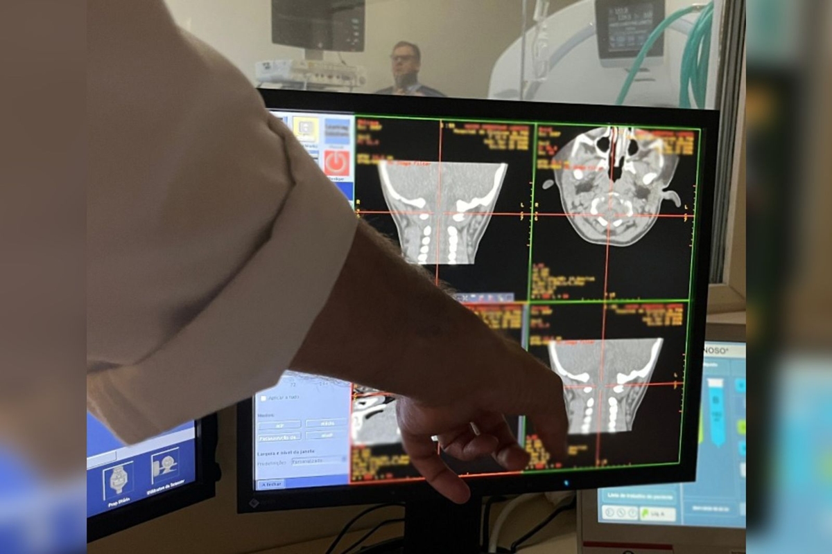 Fiocruz inicia teste em humanos de terapia gênica inédita contra AME