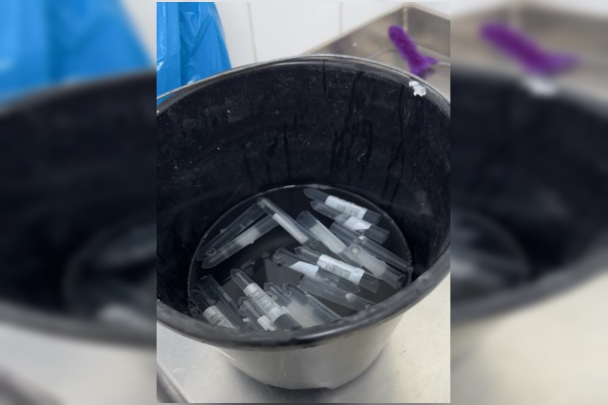 Sem estoque, hospital do DF reutiliza frascos de exame de urina. Veja vídeo