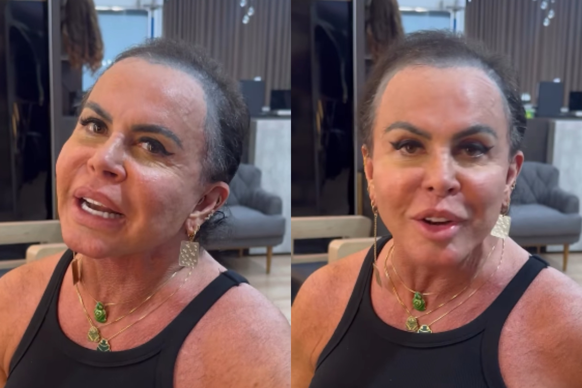 Gretchen aparece sem prótese capilar e revela destino de cabelo