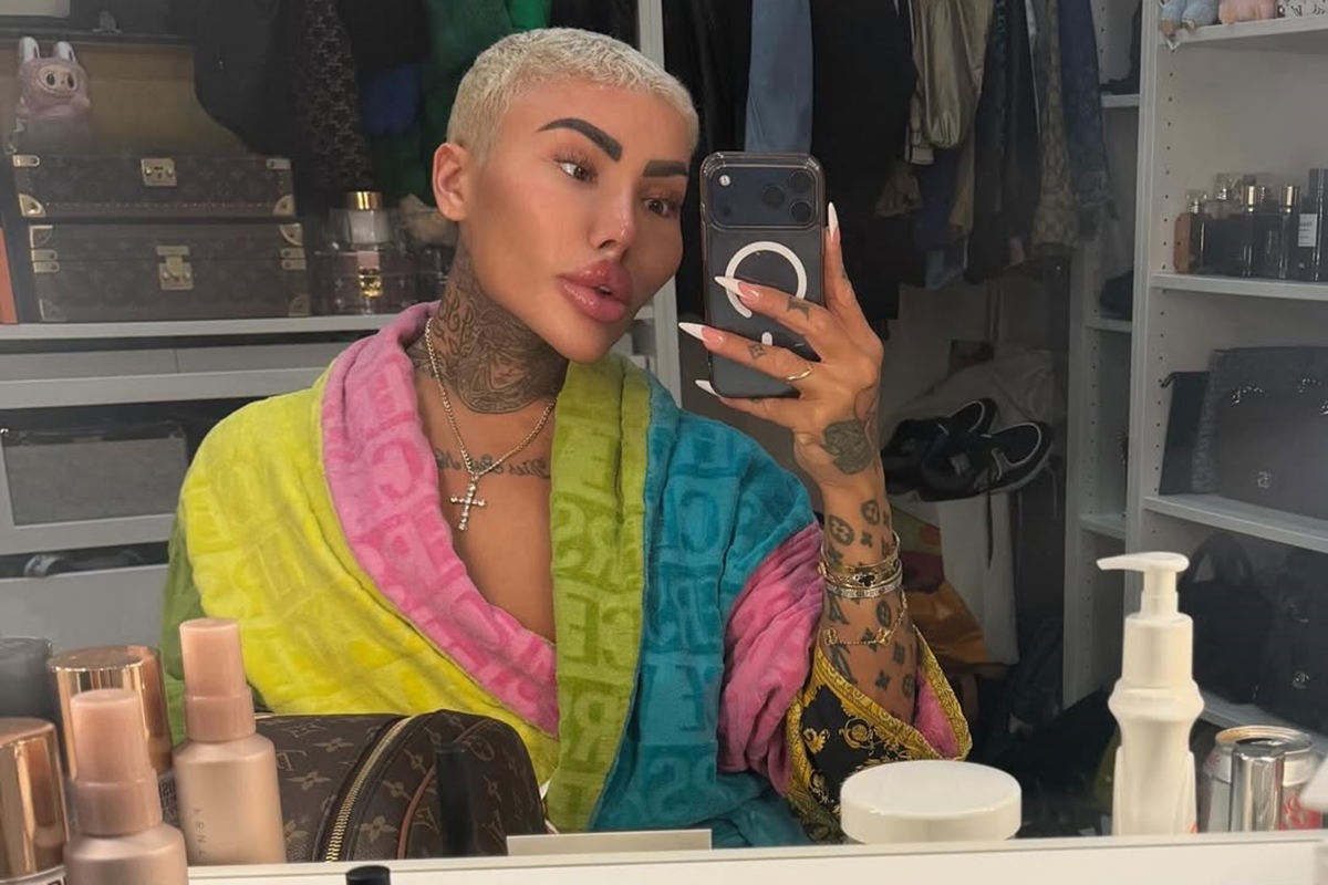 Morre Jordan James Parke, o “Rei dos Lábios” de Botched, aos 34 anos