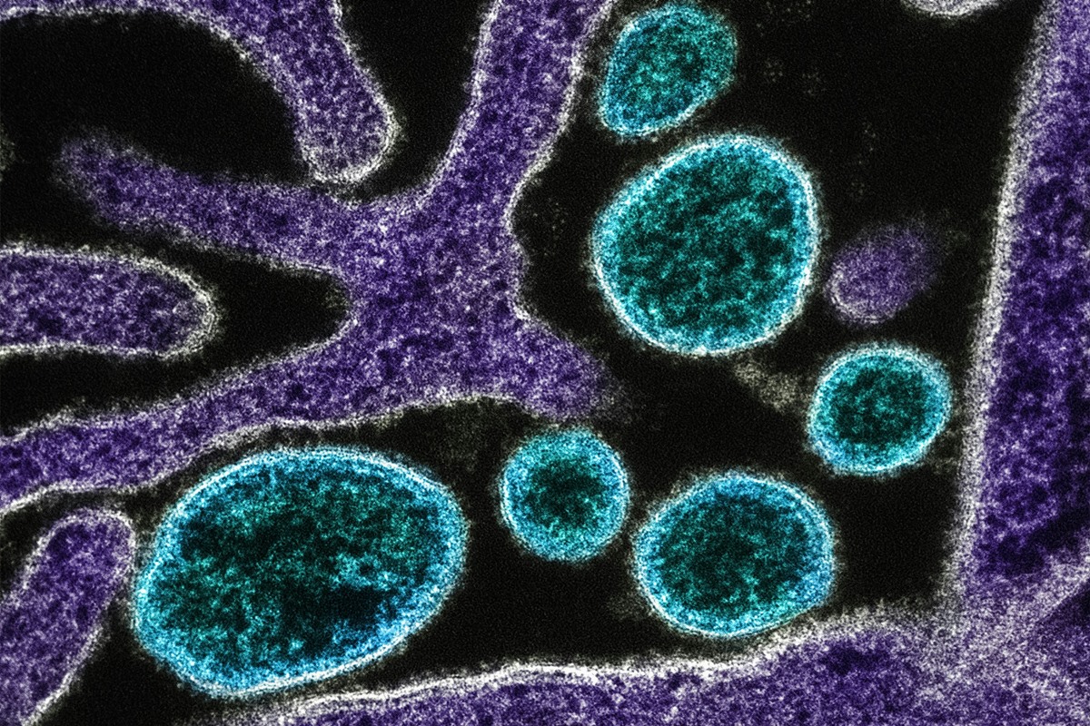 OMS confirma morte por vírus Nipah em Bangladesh